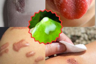 Fig Sap Secrets: Discover the Powerful Benefits and Fun Ways to Use It You Never Knew Existed! (NH)