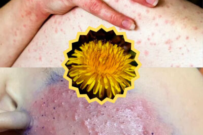 From Weed to Wonder: Discover the Health Benefits of Dandelions (NH)