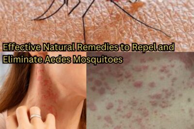 Effective Natural Remedies to Repel and Eliminate Aedes Mosquitoes (NH)