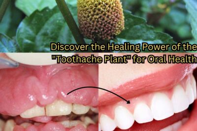 Discover the Healing Power of the “Toothache Plant” for Oral Health (NH)