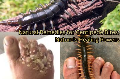 Natural Remedies for Centipede Bites: Nature’s Healing Powers (NH)