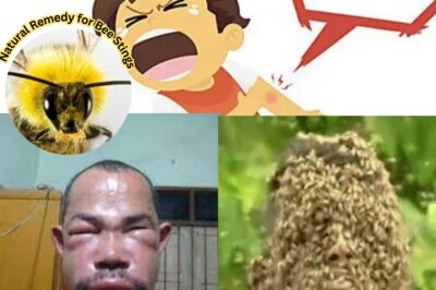 Natural Remedy for Bee Stings: Soothing Relief with Baking Soda and Honey (NH)