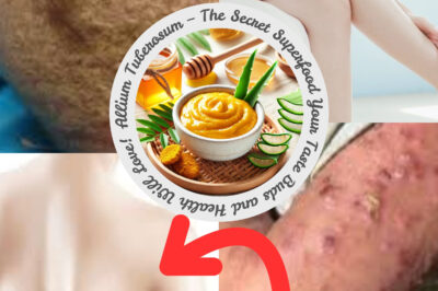 Nature’s Best Kept Secrets: The Ultimate Herbal Remedies for Skin Inflammation (NH)