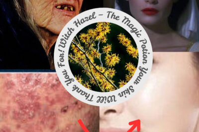 Witch Hazel – The Magic Potion Your Skin Will Thank You For! (NH)