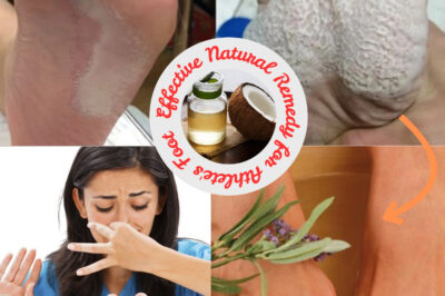 Effective Natural Remedy for Athlete’s Foot: Simple and Powerful Formula (NH)
