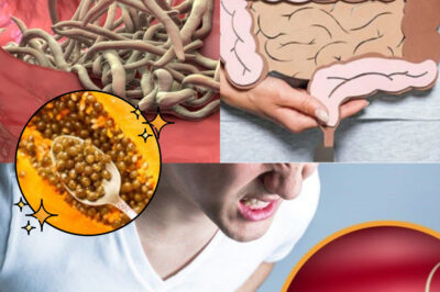 Natural Remedy to Help Eliminate Intestinal Worms: Papaya Seeds! (NH)