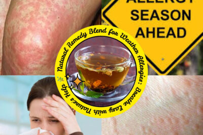 Natural Remedy Blend for Weather Allergies: Breathe Easy with Nature’s Help (NH)