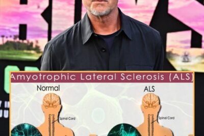 Eric Dane reveals ALS diagnosis: What to know about the rare disease