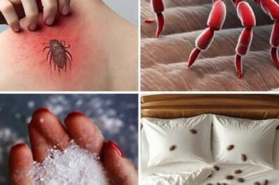 Bedbugs: Simple Methods to Eradicate Them from Your Home (an)