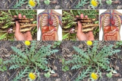 20 Motivos Convincentes para Colher Flores de Dente-de-Leão Até Suas Mãos Ficarem de um Amarelo Radiante. /lo