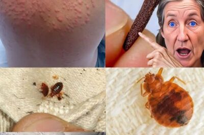 Bedbugs: Simple Methods to Eradicate Them from Your Home /d