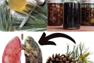 O MEDICAMENTO NATURAL MAIS FORTE PARA OS PULMÕES DOENTES! Previne o CANCRO, BRONQUITE, ASMA… Feito a partir de Pinheiros