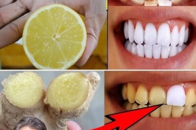 Whiten Your Teeth and Instantly Freshen Your Breath with the Natural Power of Ginger and Baking Soda /d