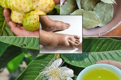 The Ultimate Healing Tonic: A Powerful Drink to Combat Swollen Feet, Diabetes, and Poor Circulation /d