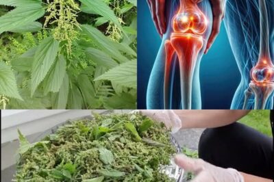 The Power of Urtica dioica: Natural Relief for Joint Pain, Arthritis, and Inflammation