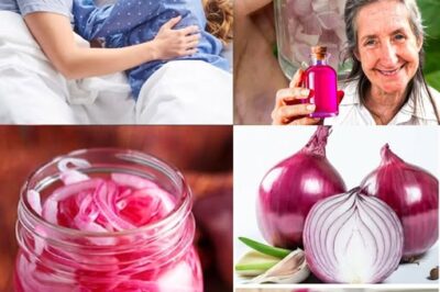 The Incredible Health Benefits of Pickling Purple Onion in Honey /d