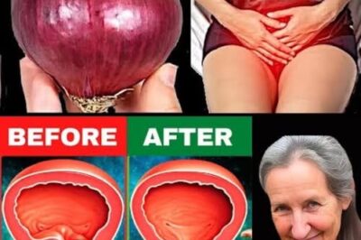 The Power of Onions: A Natural Boost for Prostate Health /d