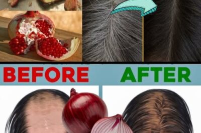 🧅 Say Goodbye to Hair Fall: Discover the Power of Onion Hair Oil for Stronger, Healthier Hair! /d