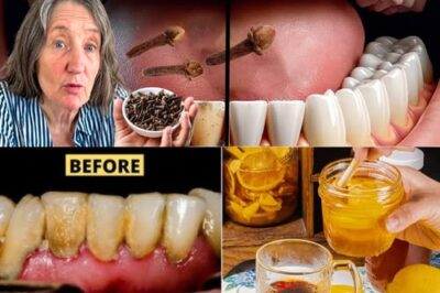 9 Powerful Natural Ways to Remove Plaque and Tartar Buildup from Your Teeth /d