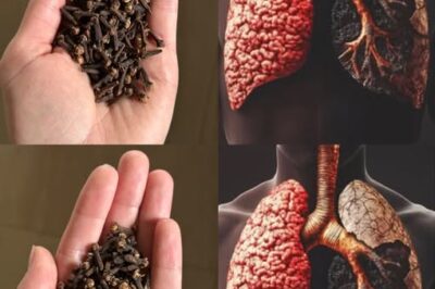 How to Use Cloves to Combat Respiratory Infections and Bronchitis /d