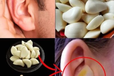 🧄 Natural Relief for Ear Discomfort: The Garlic Oil Remedy You’ve Been Missing /d