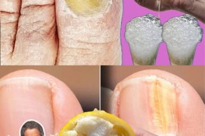 Support Healthier Toenails Naturally: How Lemon and Garlic May Help with Nail Discomfort /d