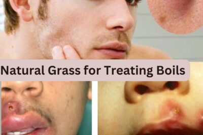 Natural Grass for Treating Boils: An Effective Solution That You Never Know Before (NH)