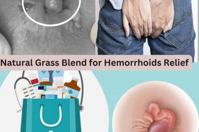 Discover the Powerful Natural Grass Blend That Can Relieve Hemorrhoids Fast and Naturally – You Won’t Believe How Effective It Is! (NH)