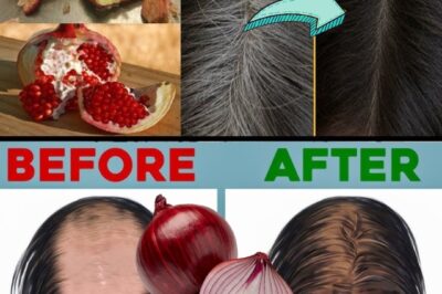 🧅 Say Goodbye to Hair Fall: Discover the Power of Onion Hair Oil for Stronger, Healthier Hair! (an)