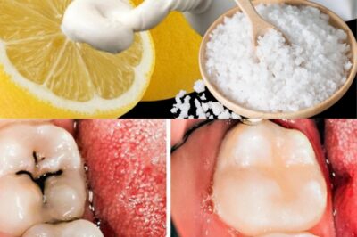 Reverse Early Cavities Naturally: 6 Proven Ways to Strengthen Enamel at Home (an)