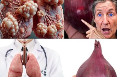 Clear Your Lungs and Ease Coughing in Just Three Days with This Powerful Onion Remedy