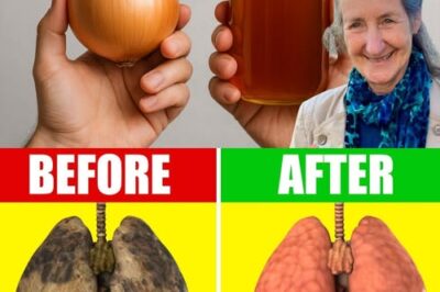 Breathe Easy Again: A Natural Way to Soothe Your Lungs with Onion and Honey
