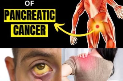 8 Shocking Symptoms of Pancreatic Cancer You Should NEVER Ignore